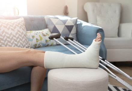 Broken ankle and a leg cast