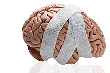 Brain Injury stock photo